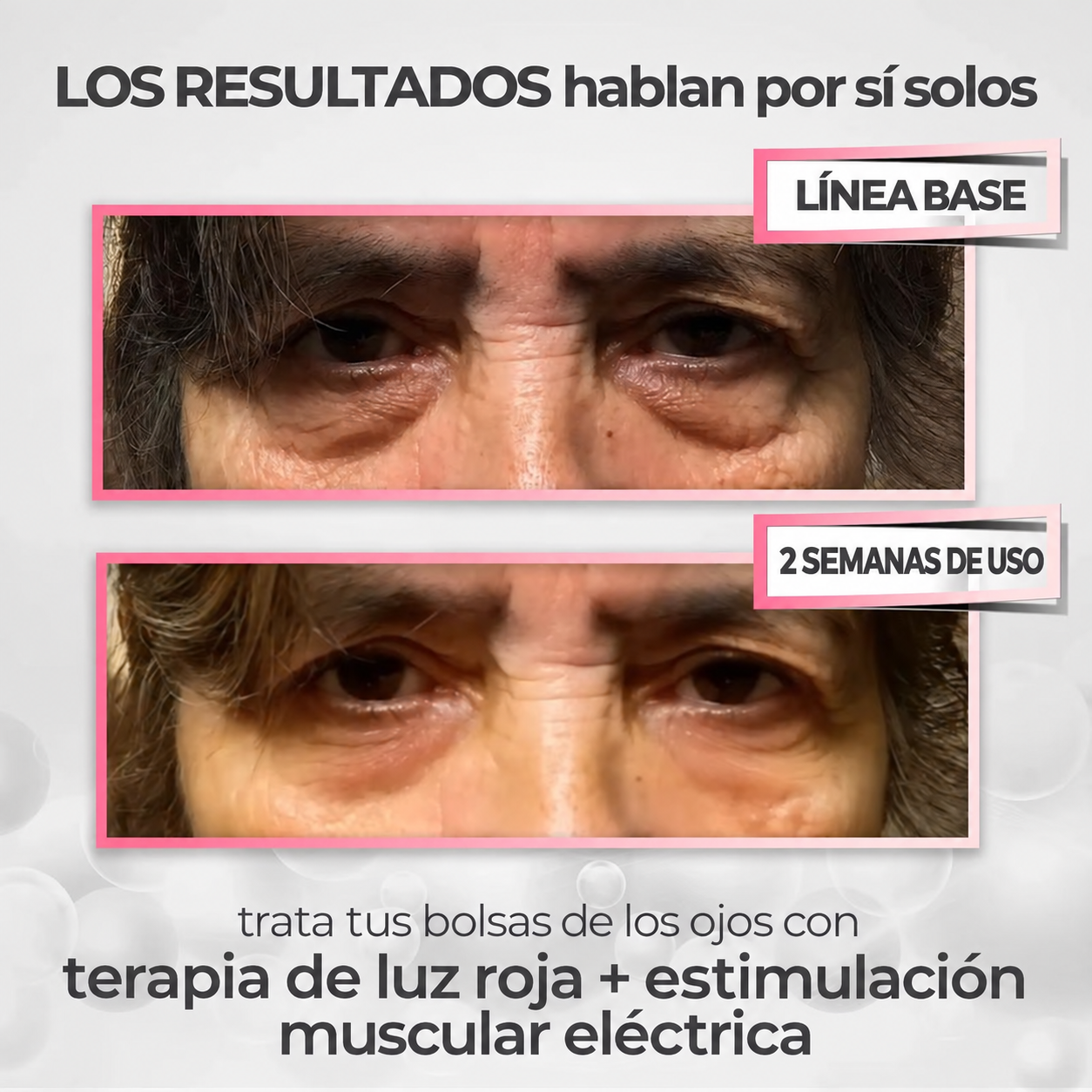 Crema Antiojeras + Masajeador de Luz Roja